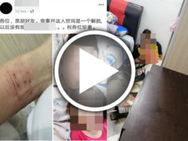 面书发有自杀意图帖子 男子捅腹自残