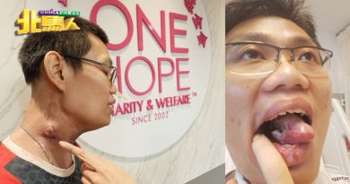 保险职员独自抗舌癌 “父母过世没家人，请救救我！