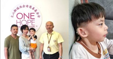 双耳听力受损 4岁仍无法说话 男童需植入人造耳蜗